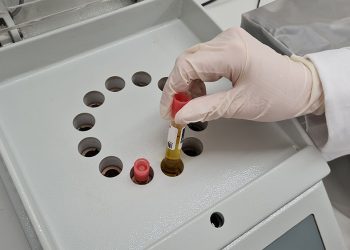 laboratory tests for wastewater quality